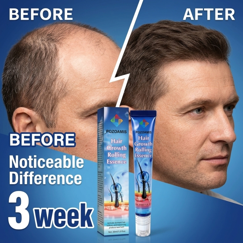 Portable Roller‑Ball Scalp Nou - Hair Care Daily Routine 评论和价格