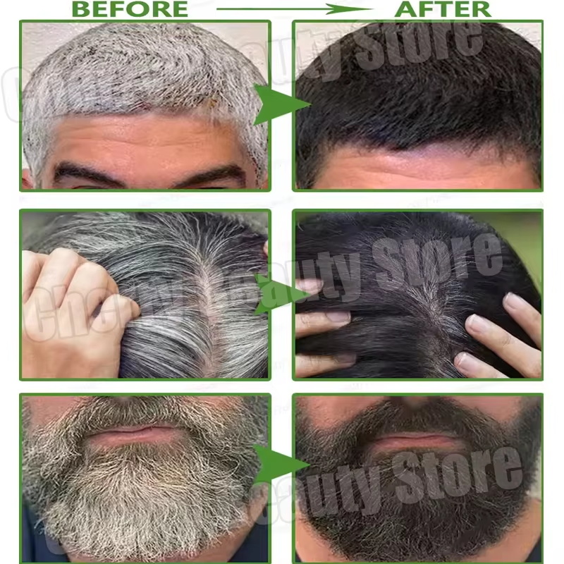Natural Gray White Hair Treatm - Hair Care Natural Products 评论和价格